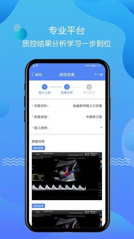 超声智库官方版下载,超声智库,诊断app,医疗app